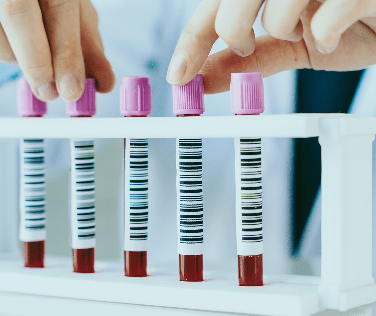 MCH/MCHC Ratio in Blood Test Results Explained