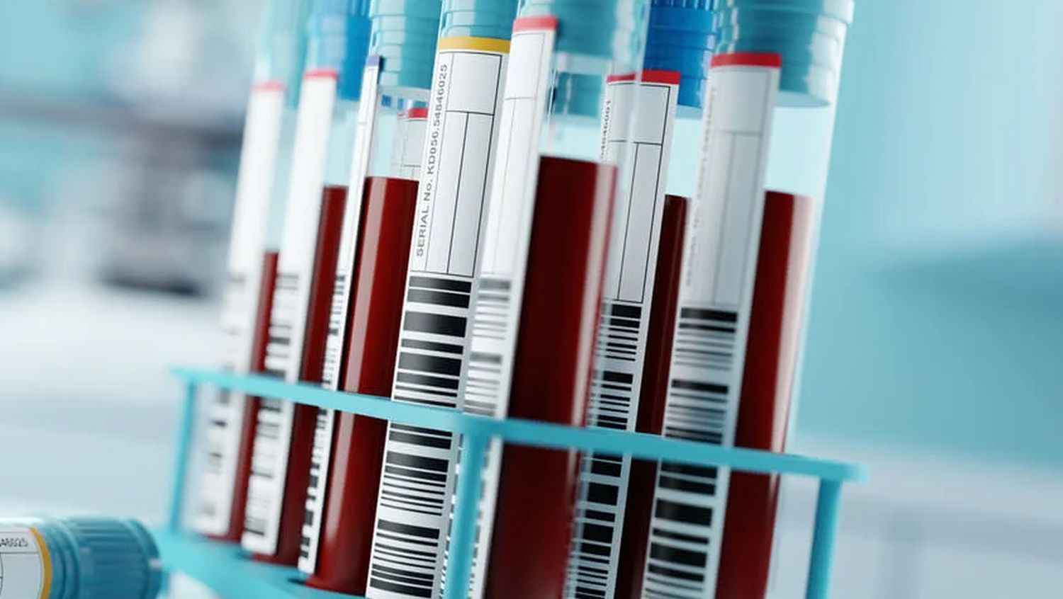 Protein/Globulin Ratio vs Albumin/Globulin Ratio