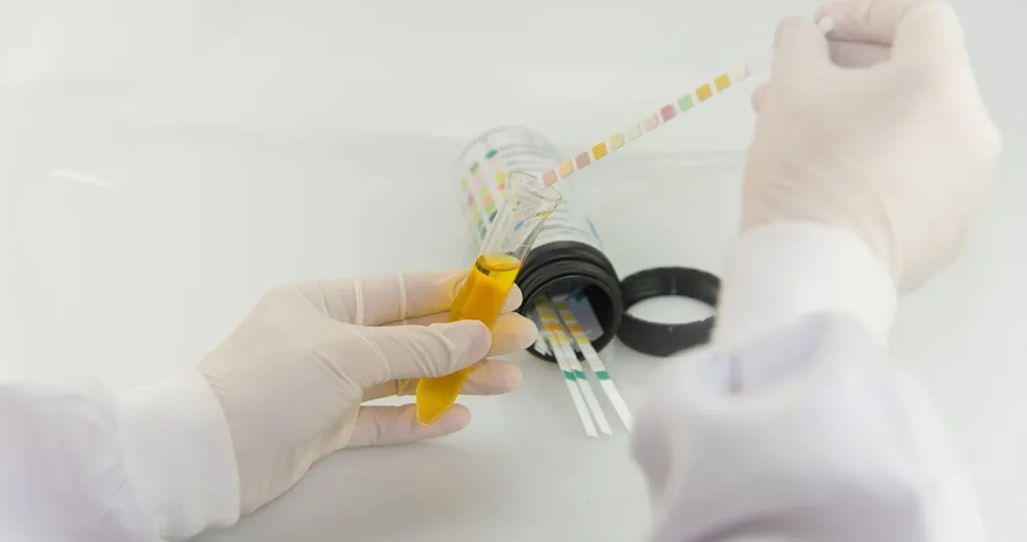 Urine Protein/Creatinine Ratio (UPCR) Results Explained