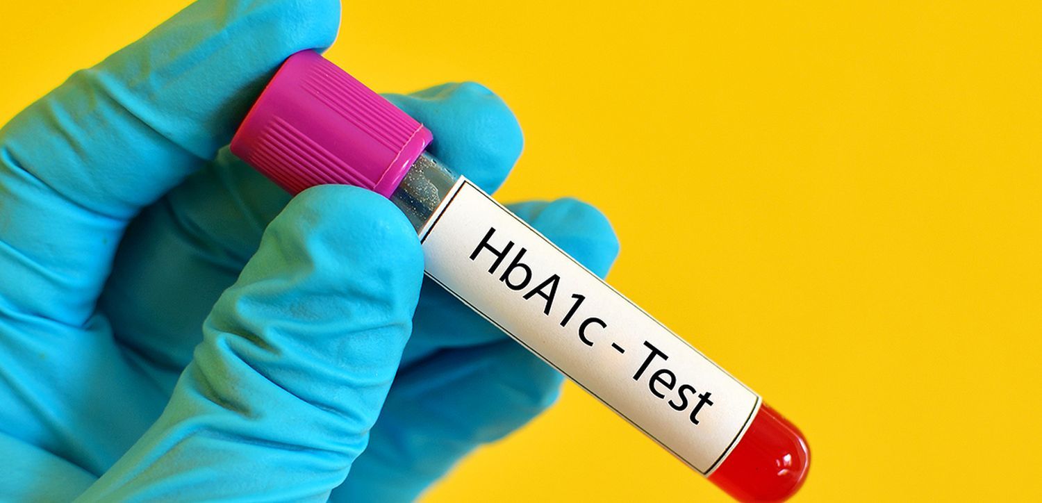 a1c test.jpg