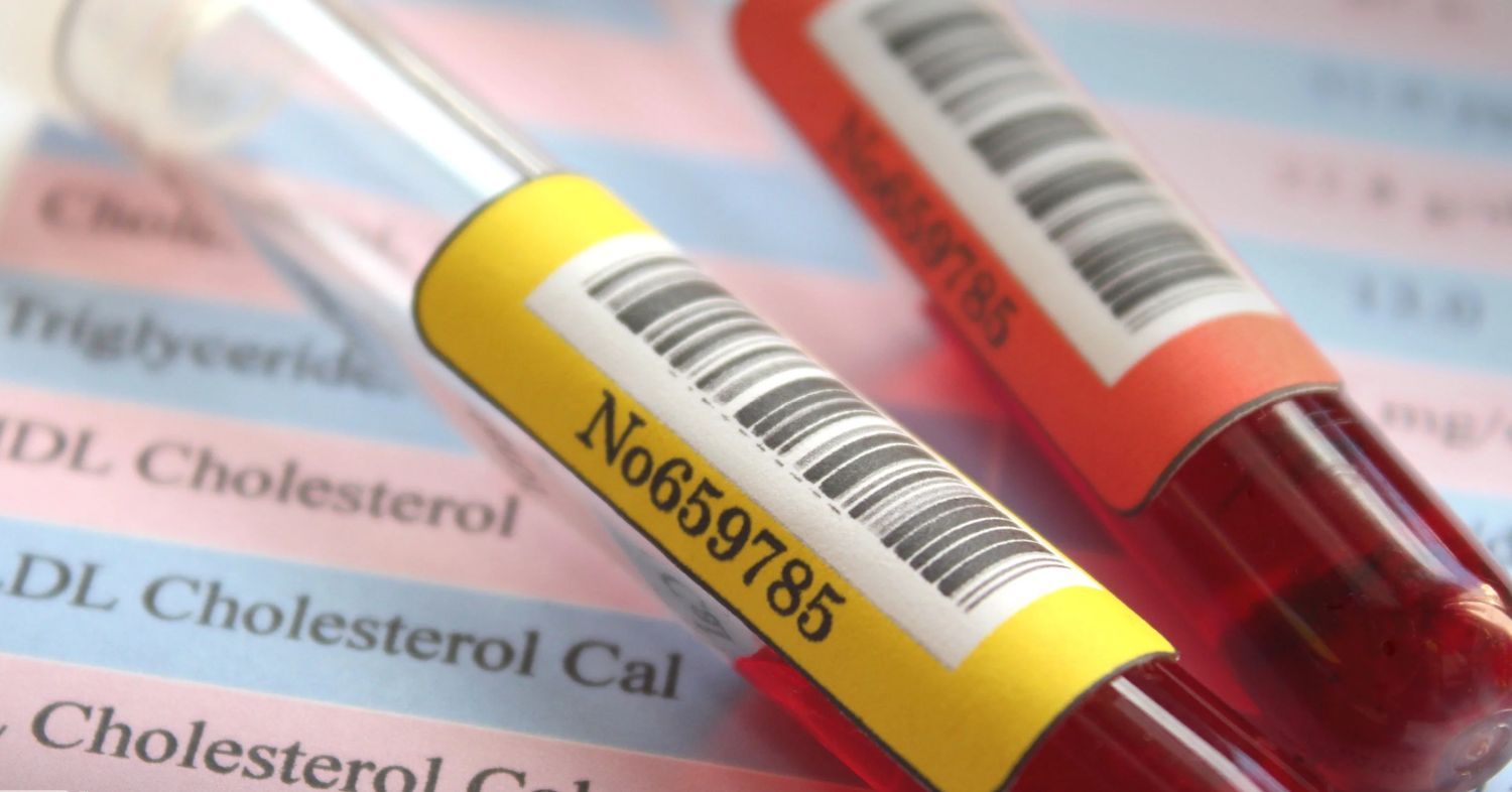 Advanced Lipid Panel Results: Beyond Basic Cholesterol