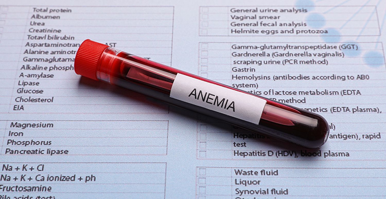 Complete Guide to Understanding Anemia Blood Test Results