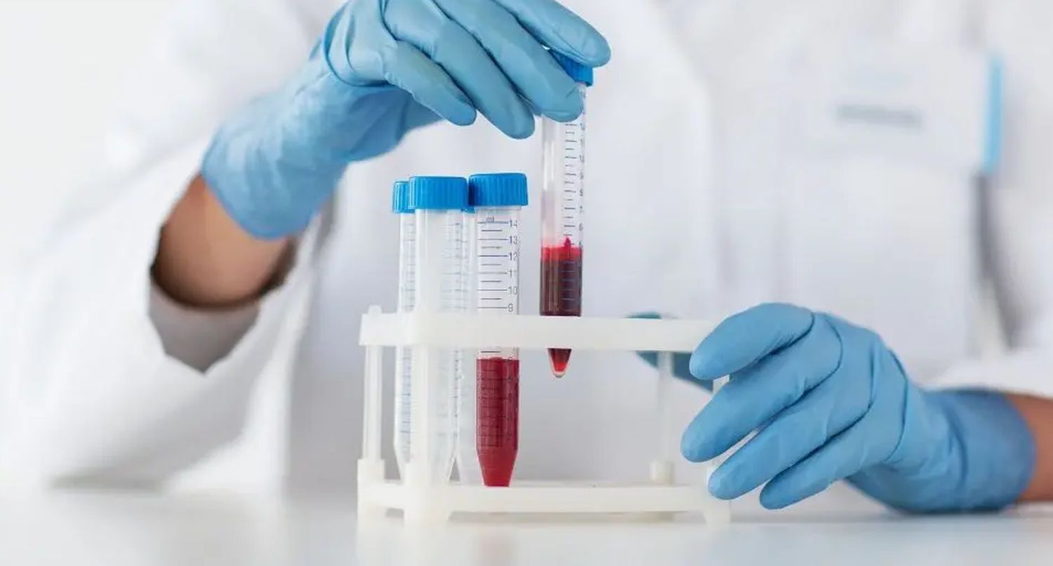 Globulin/Albumin Ratio 1.5 Test Results