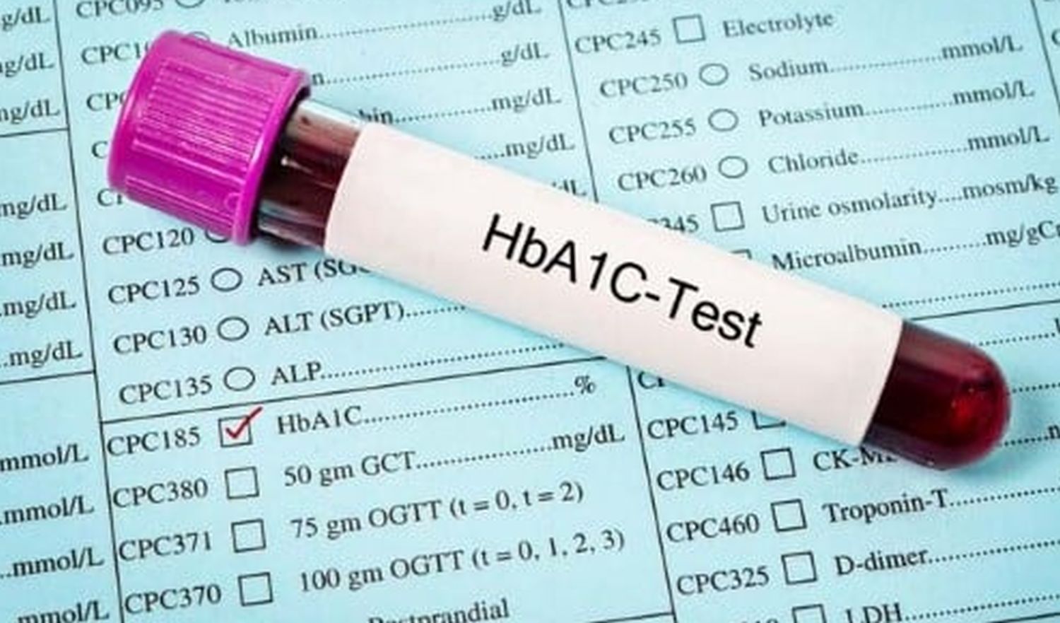 Interpreting Your A1C Test Results: Complete Blood Sugar Analysis