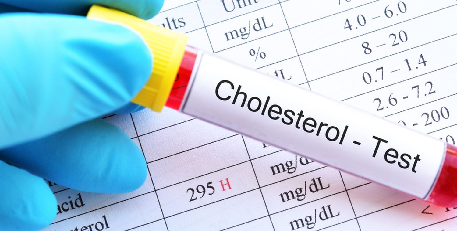 cholesterol test.jpg