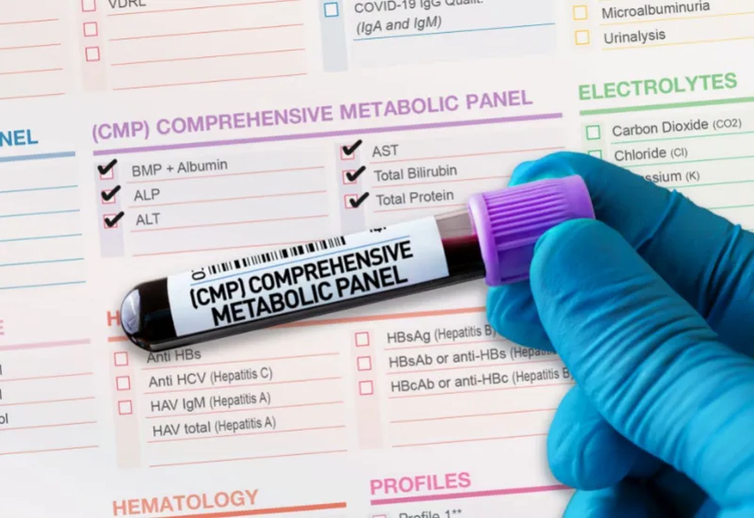 Comprehensive Metabolic Panel (CMP): Understanding Your Results