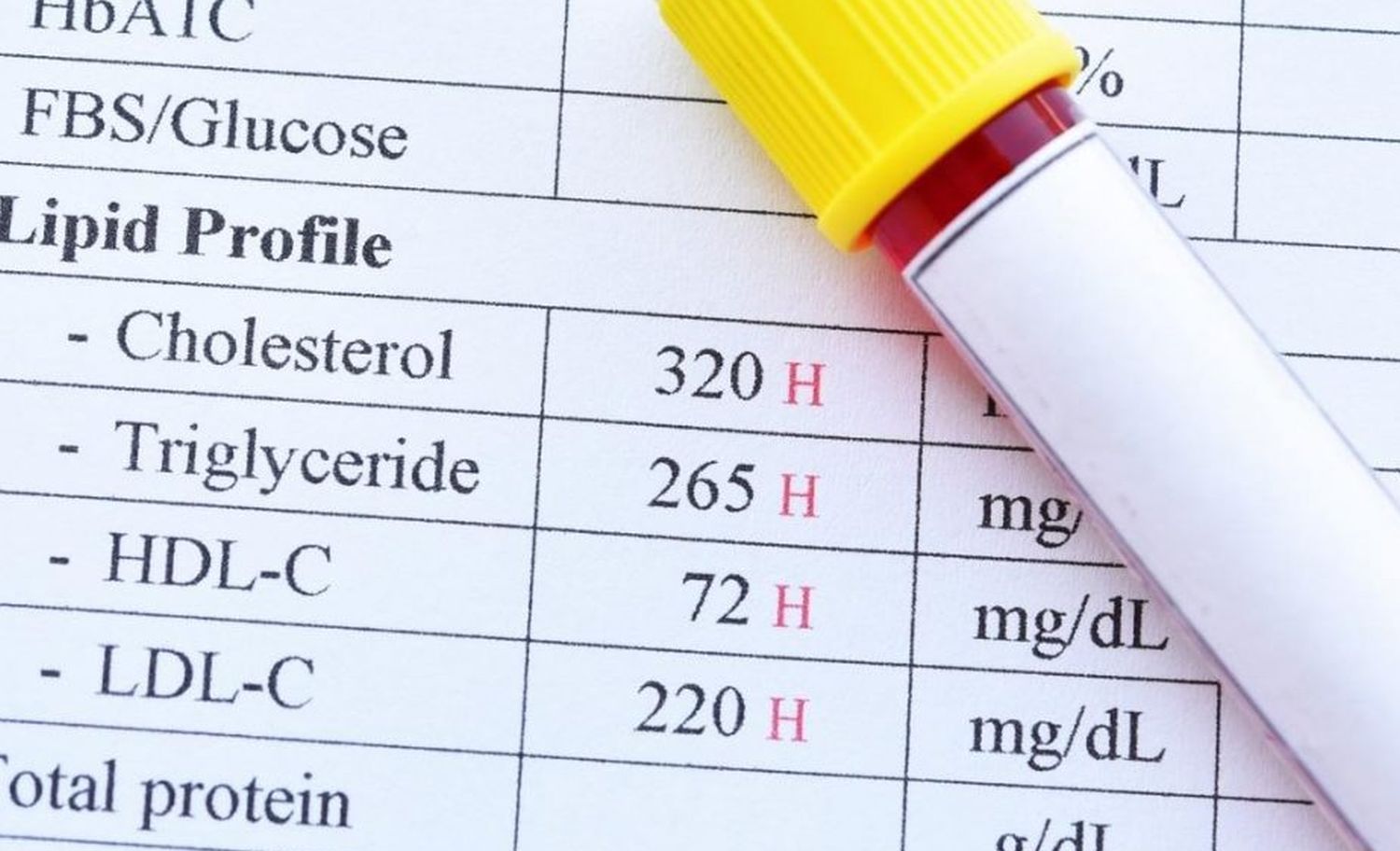 hdl vs ldl.jpg