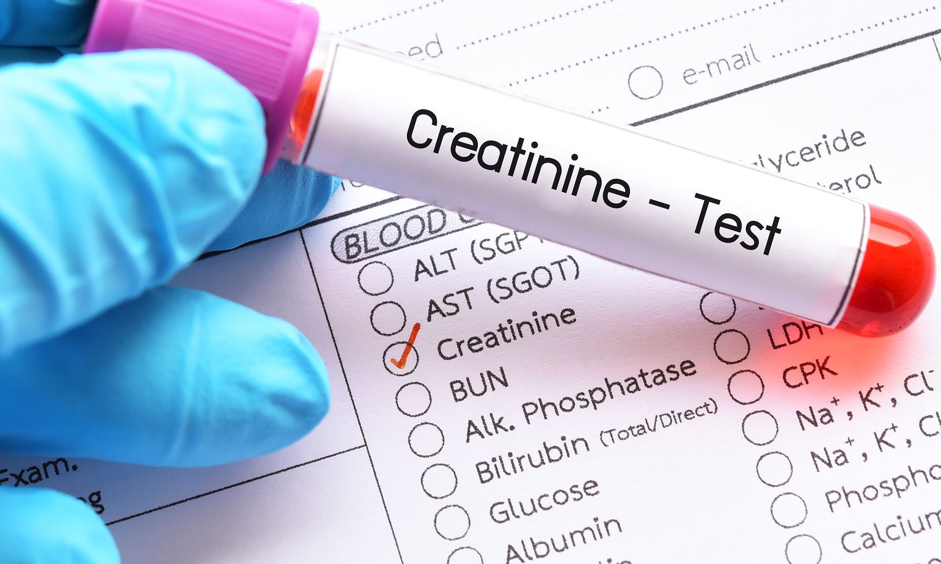 kidney test.jpg