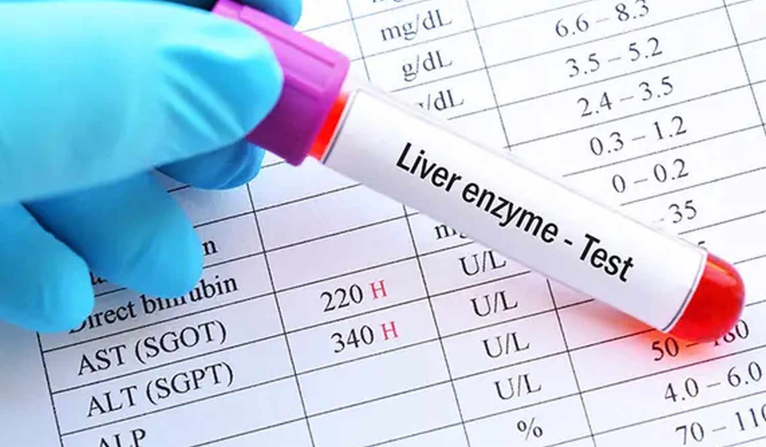 liver enzyme test.jpg