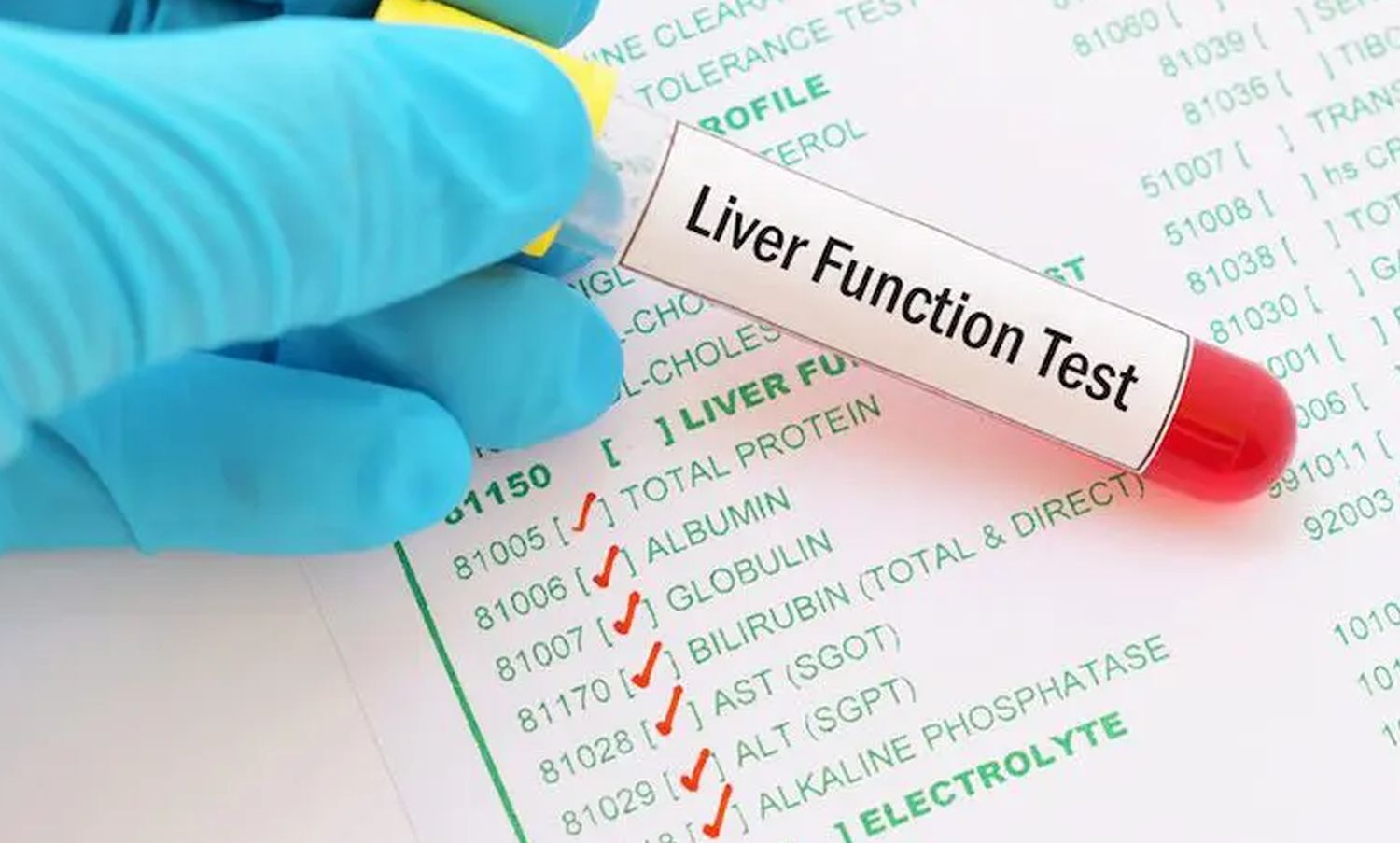 liver function test.jpg