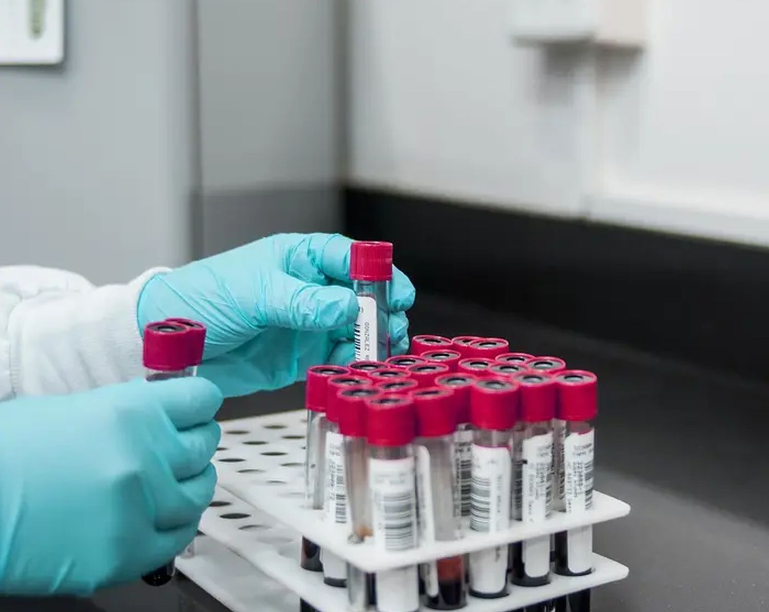 Mean Corpuscular Volume (MCV) Test Results: A Complete Guide