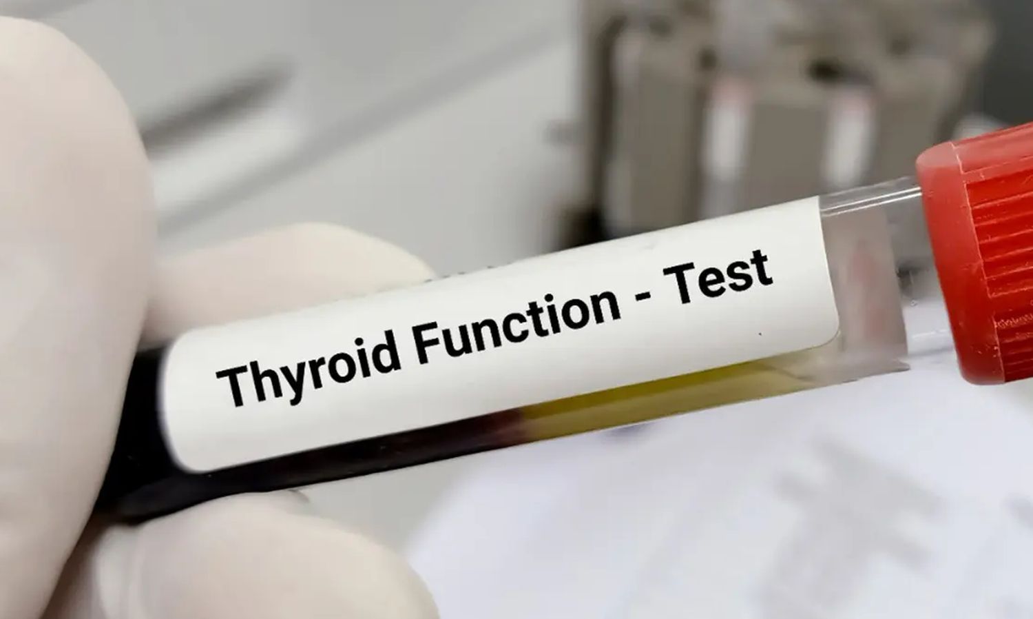 thyroid function test.jpg