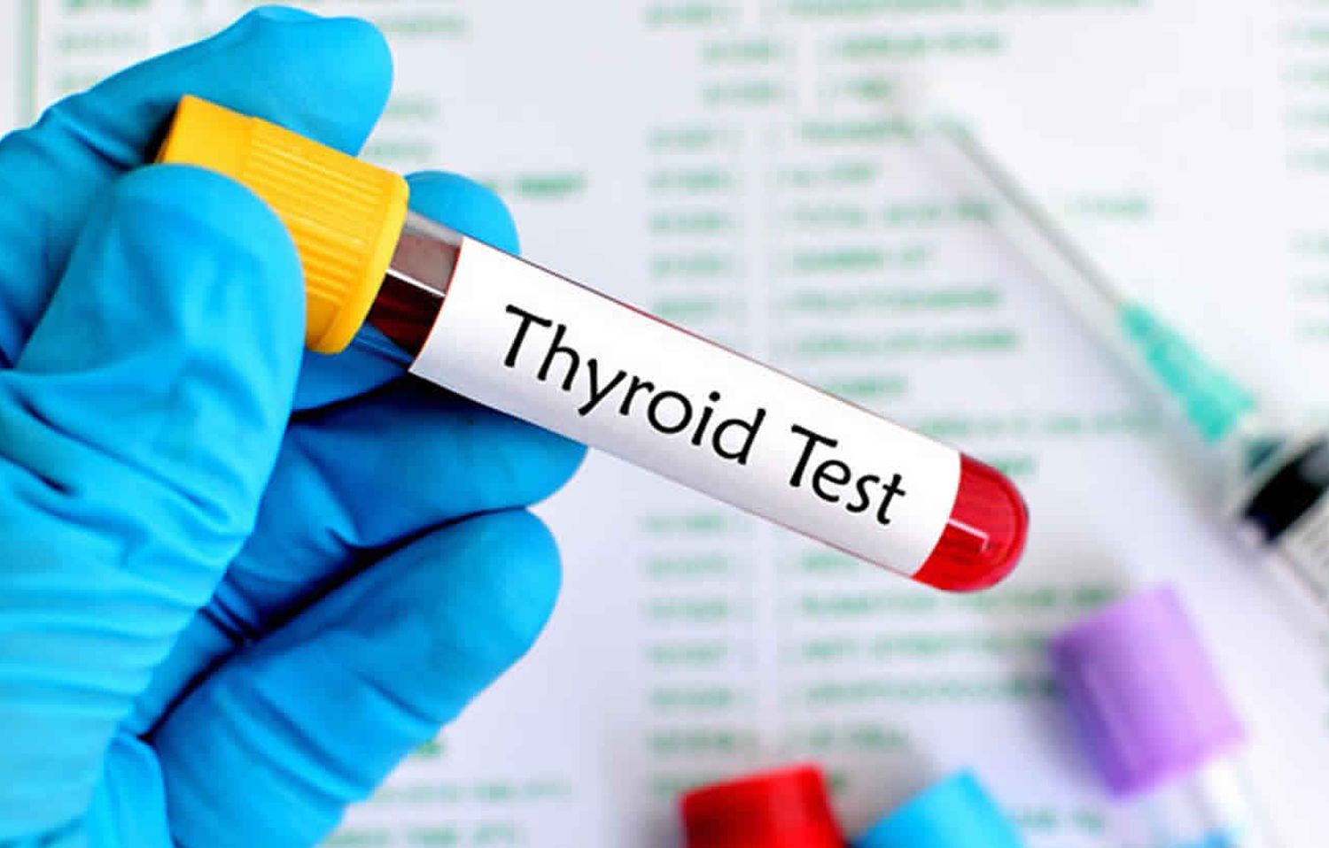 Reverse T3 Test Results Explained: Complete Guide