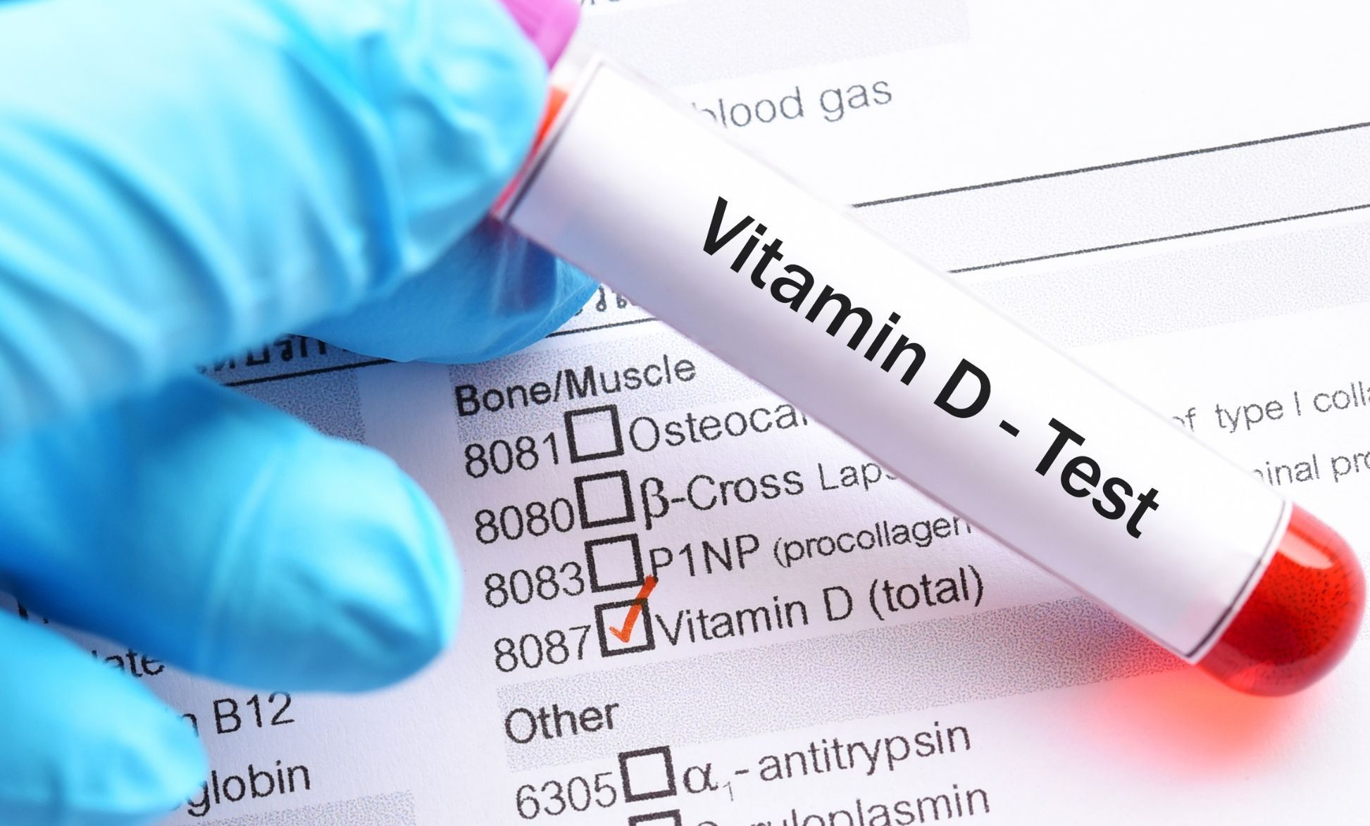 vitamin d test.jpg