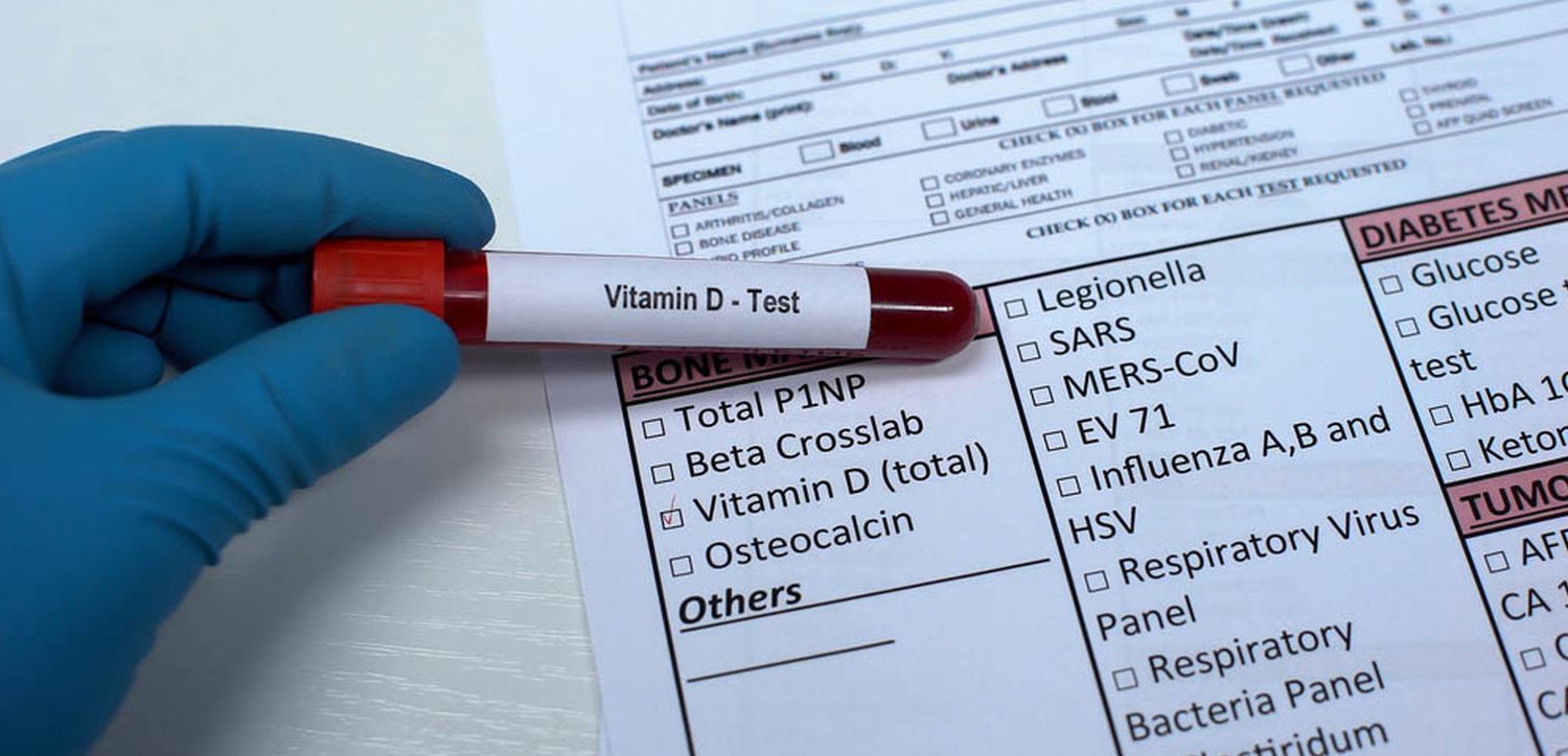 Complete Guide to Understanding Your Vitamin D Test Results